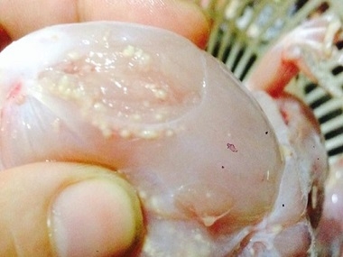 Nhiễm giun sán khi ăn gỏi ếch sống và cách điều trị