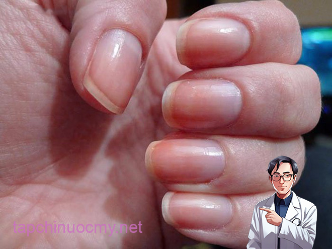 photo-1-1494469527486-1494469640317